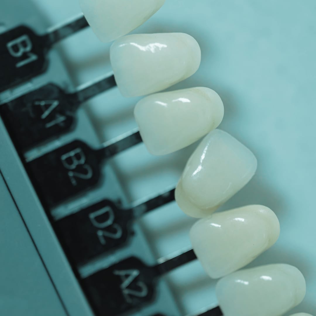 teeth whitening palette